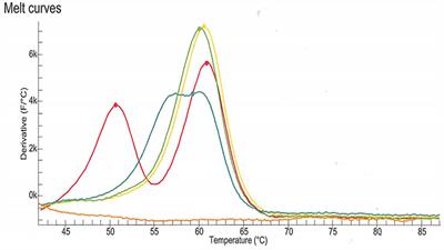 Rare Dihydropyrimidine Dehydrogenase Variants and Toxicity by Floropyrimidines: A Case Report